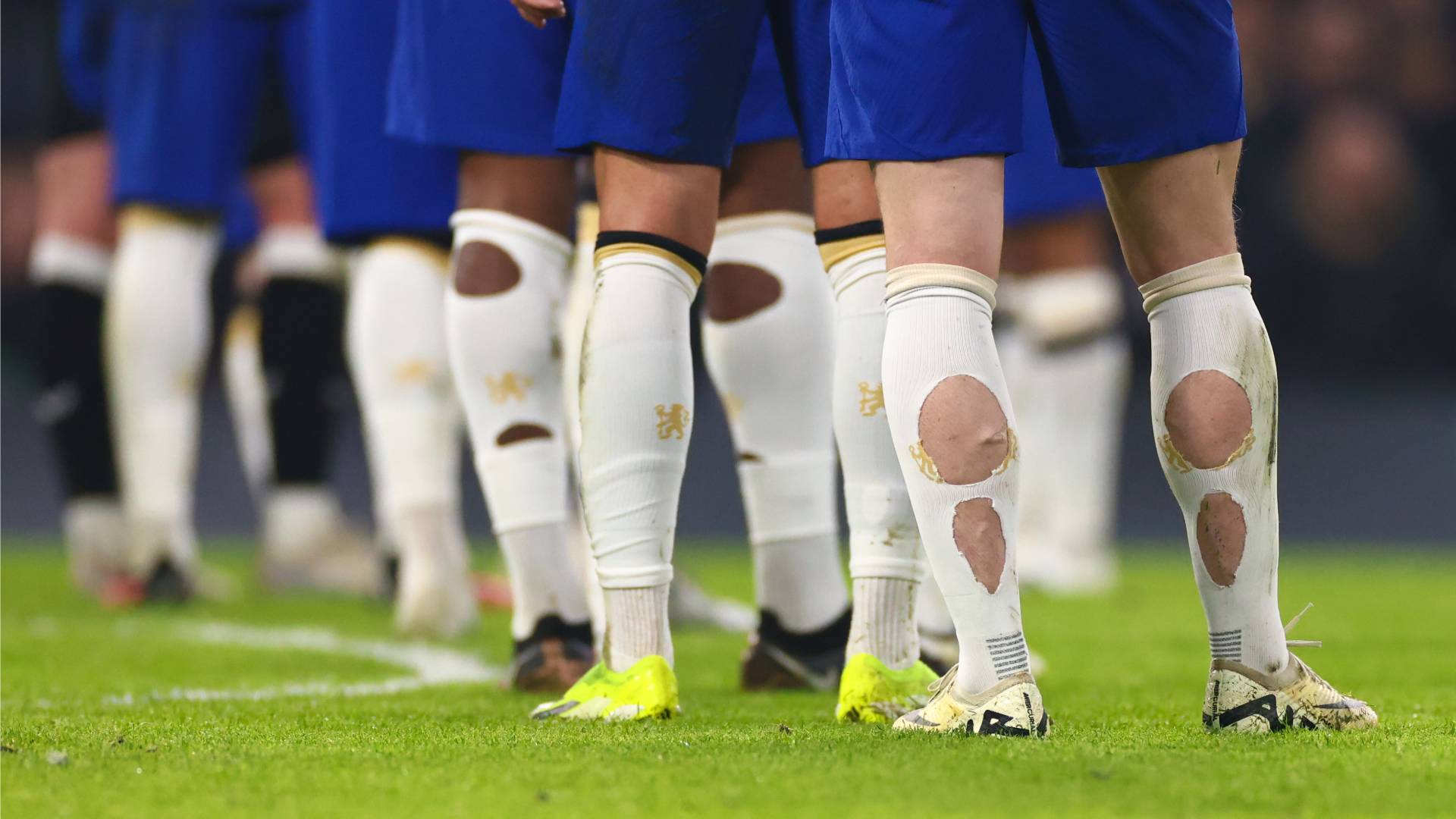 Footballers hole in socks