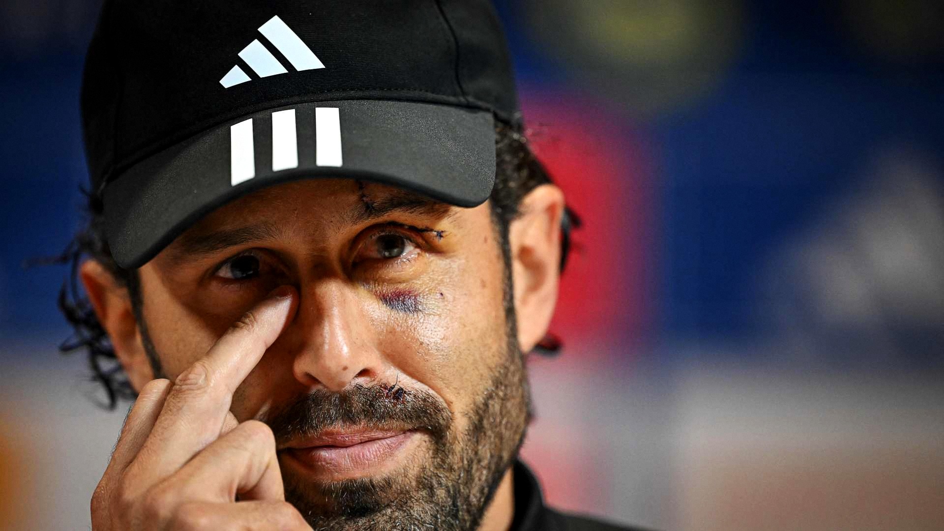 20231103-Ligue1-Lyon-Fabio-Grosso