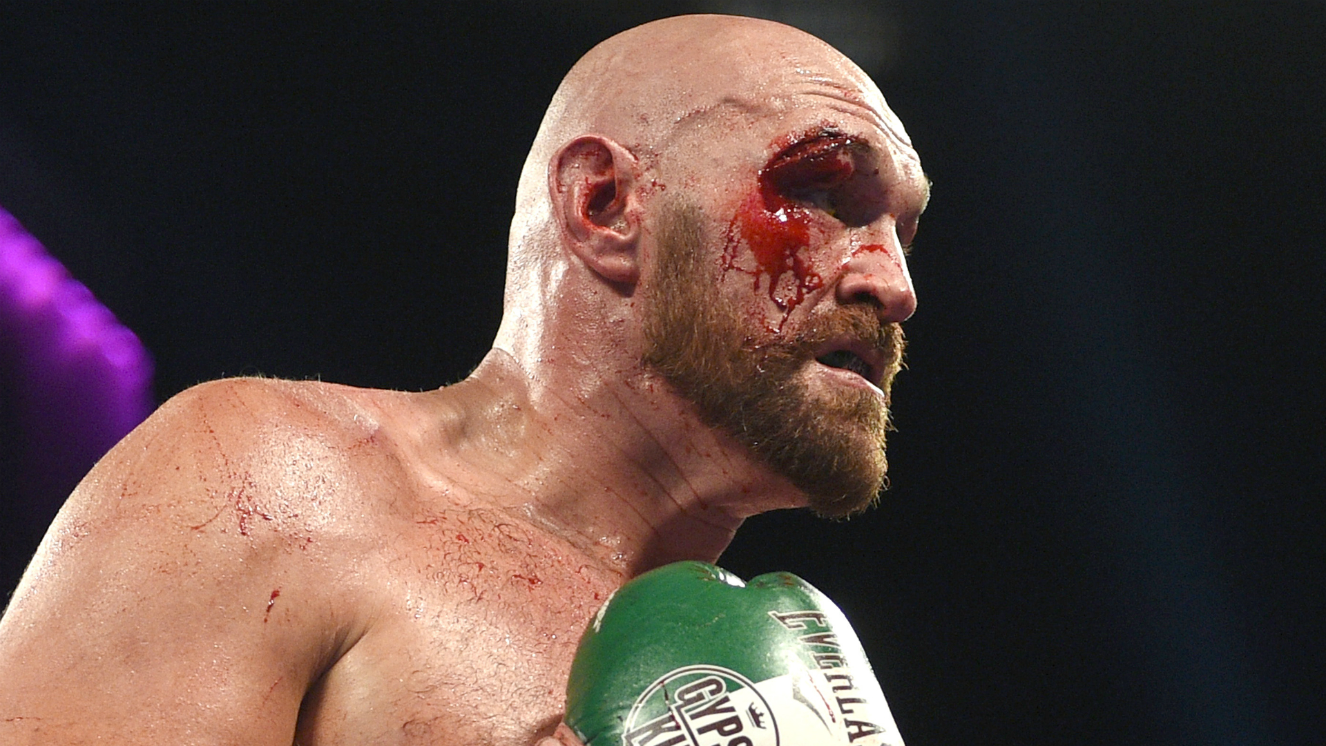 Tyson-Fury-022020-GETTY-FTR