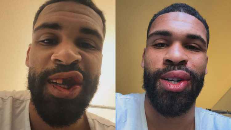 images-v3-bltbc371e547a5482e5-GOAL%20-%20Multiple%20Images%20-%202%20Split%20-%20Facebook%20-%202026-02-24T072048.873