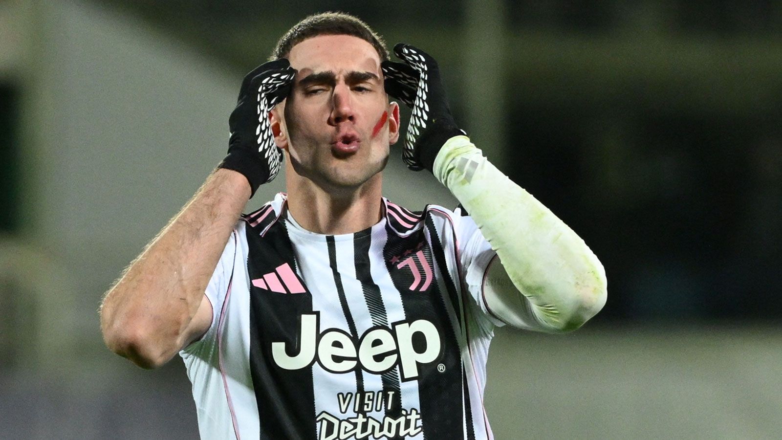 images-v3-blt828d7adfdeabb6b9-2